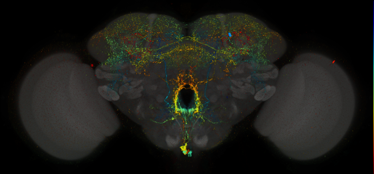 JRC_MB022B_Brain_2014_20140408_31_G2_20x