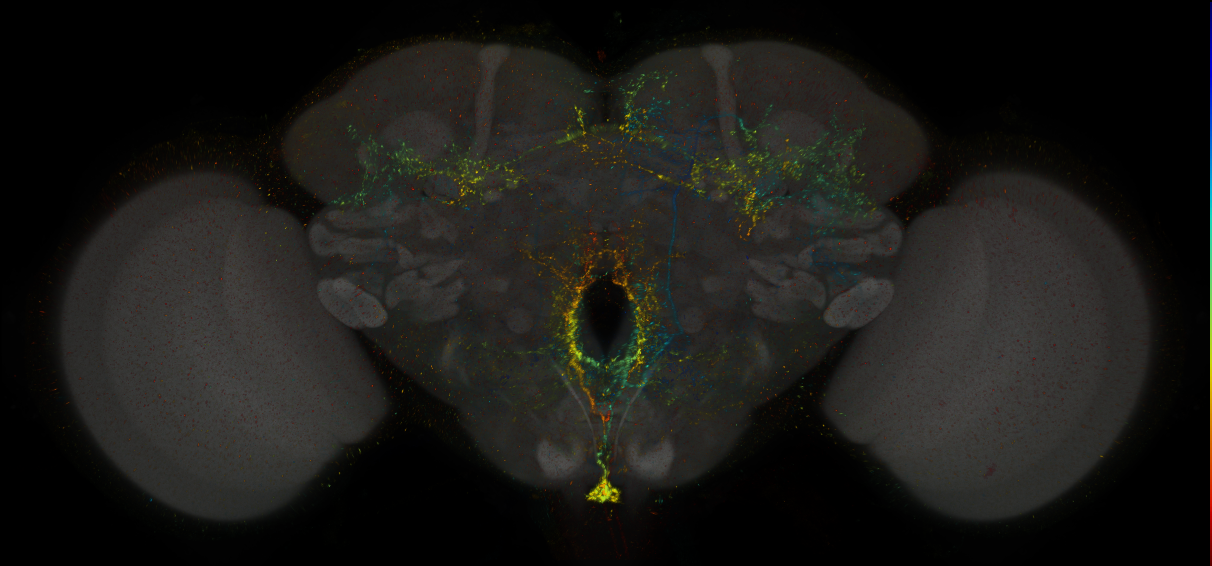 JRC_MB113C_Brain_2014_20140408_31_H4_20x