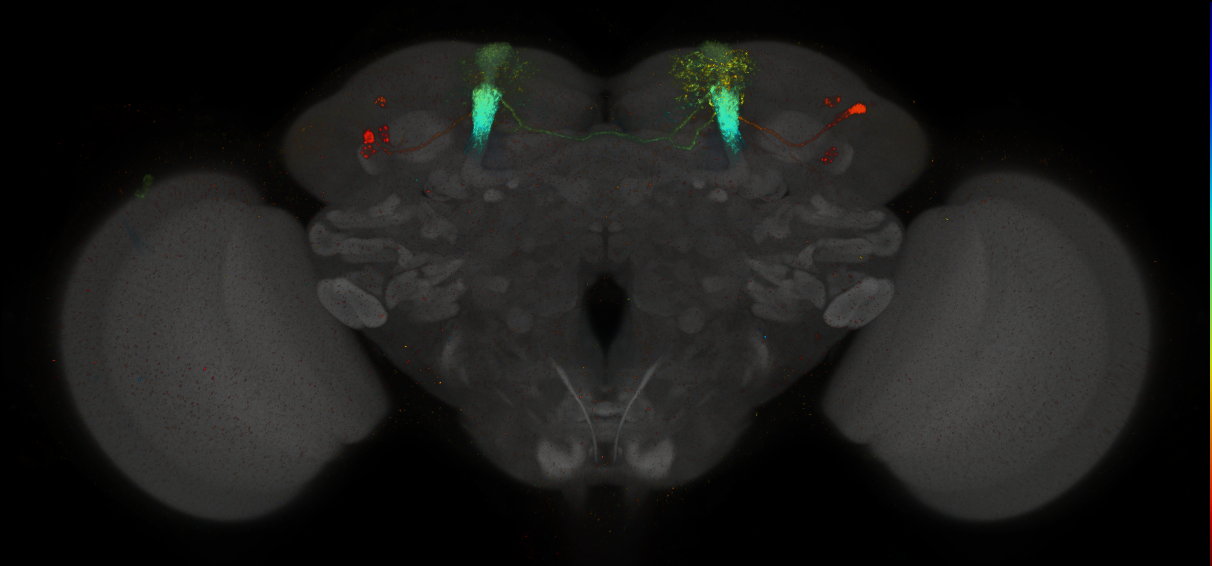 JRC_MB060B_Brain_2014_20140411_31_G3_20x