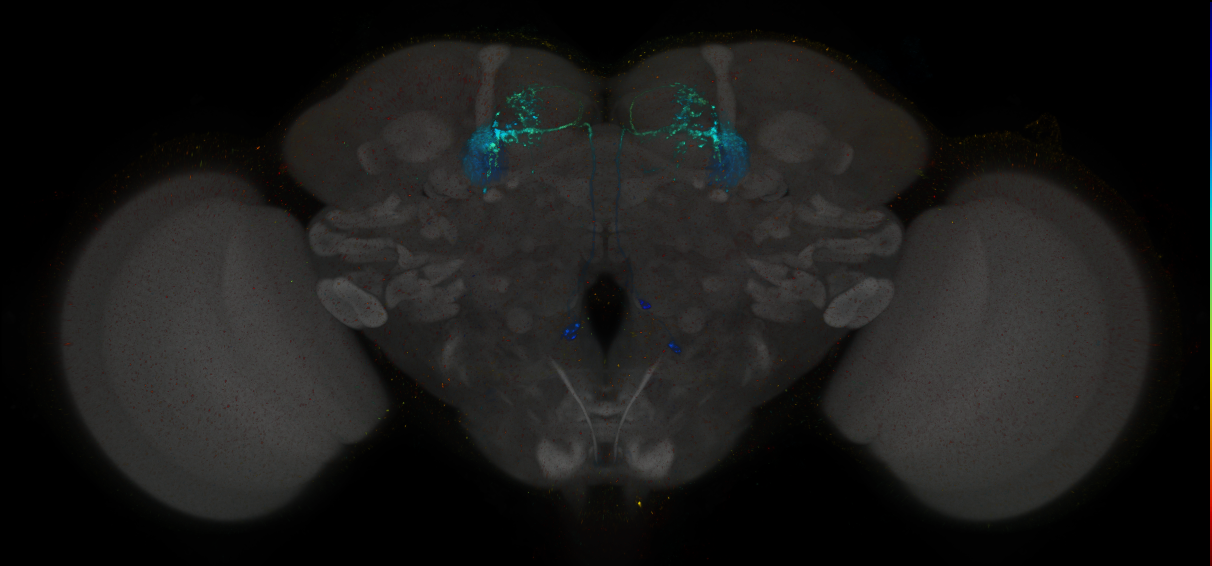 JRC_MB077C_Brain_2014_20140401_31_F3_20x