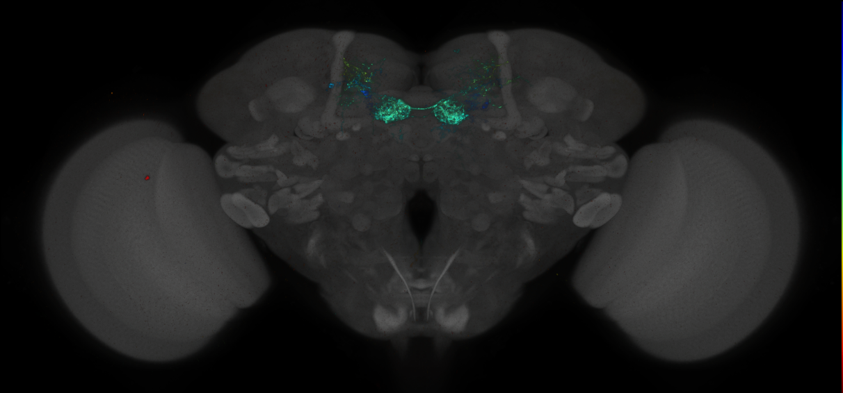 JRC_MB032B_Brain_2014_20140414_31_A2_20x