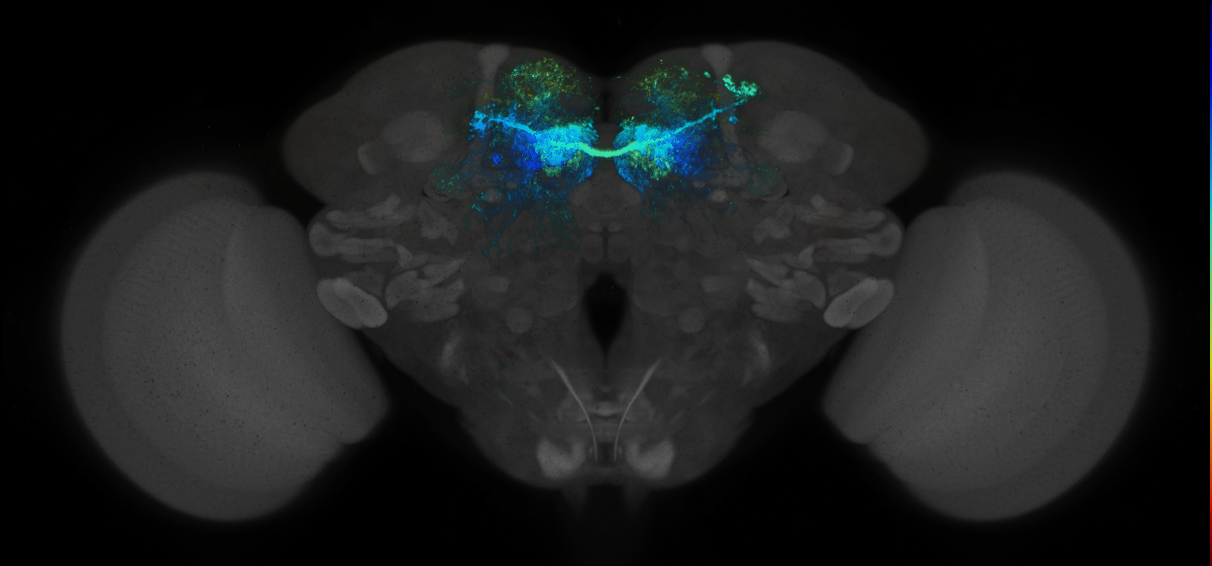 JRC_MB042B_Brain_2014_20140414_31_B5_20x