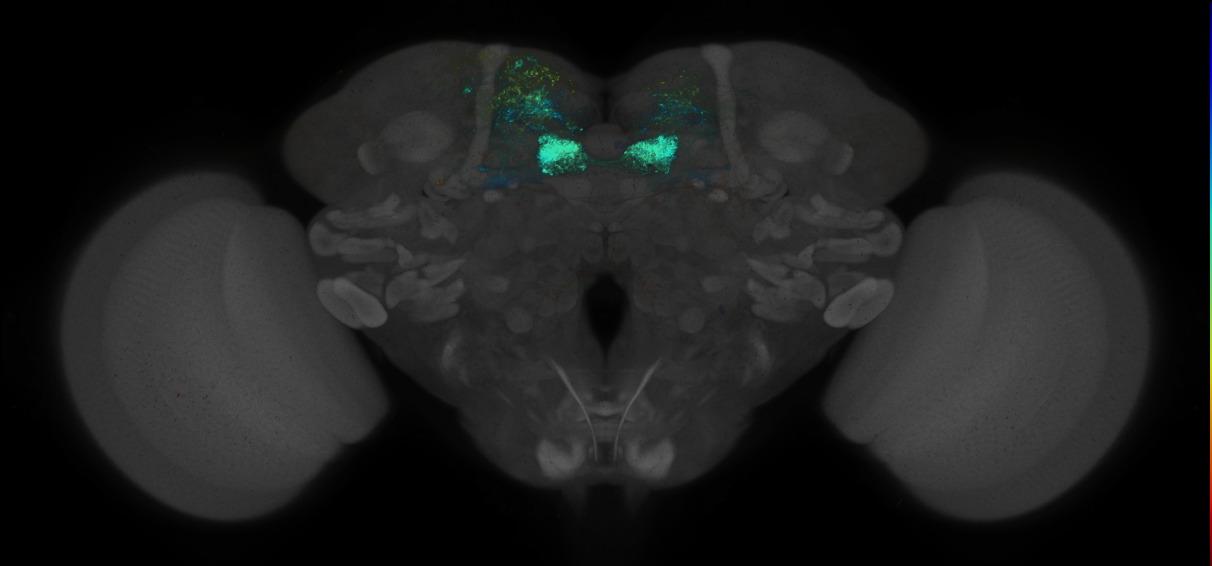 JRC_MB047B_Brain_2014_20140414_31_C1_20x