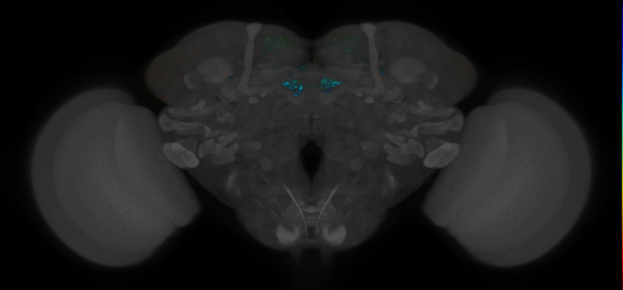 JRC_MB087C_Brain_2014_20140414_31_D1_20x