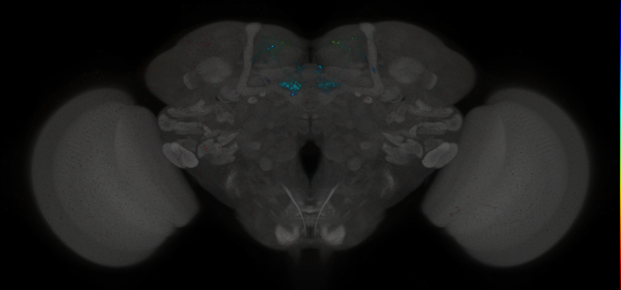 JRC_MB087C_Brain_2014_20140414_31_D2_20x
