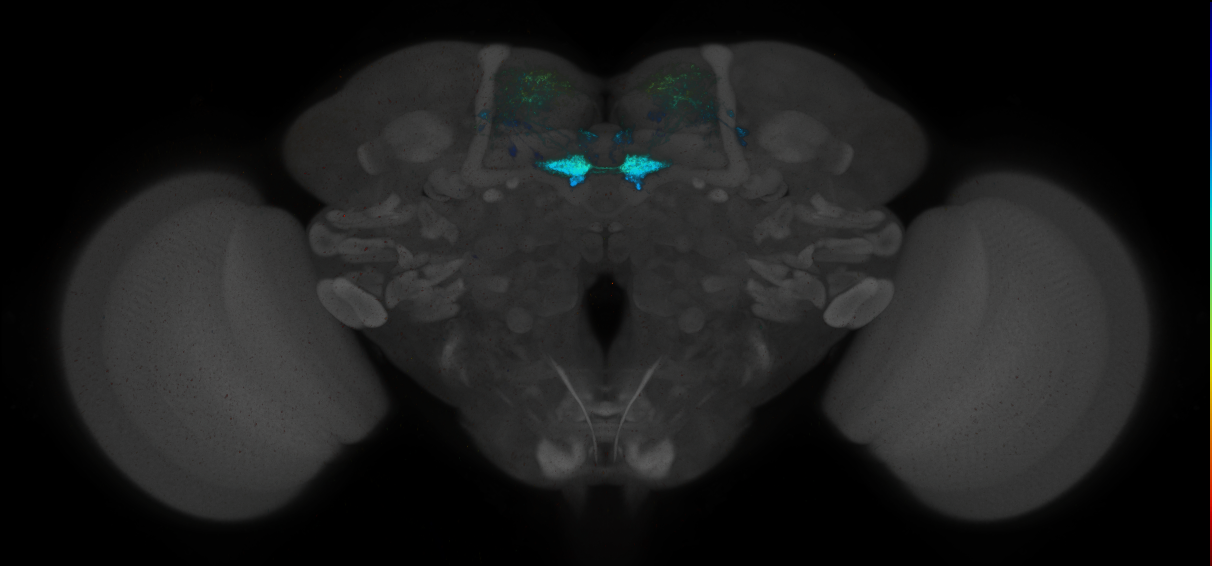 JRC_MB109B_Brain_2014_20140414_31_E1_20x
