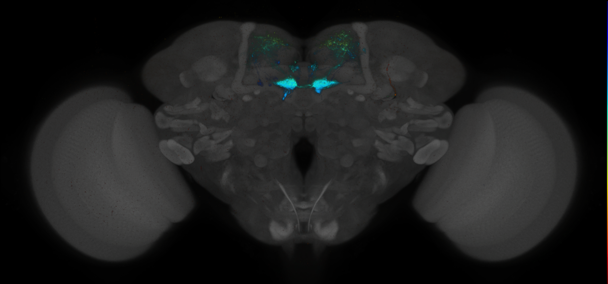 JRC_MB109B_Brain_2014_20140414_31_E2_20x