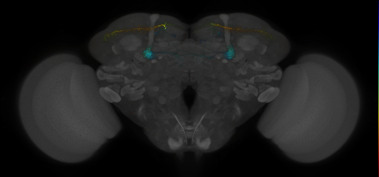 JRC_MB299B_Brain_2014_20140414_31_F1_20x