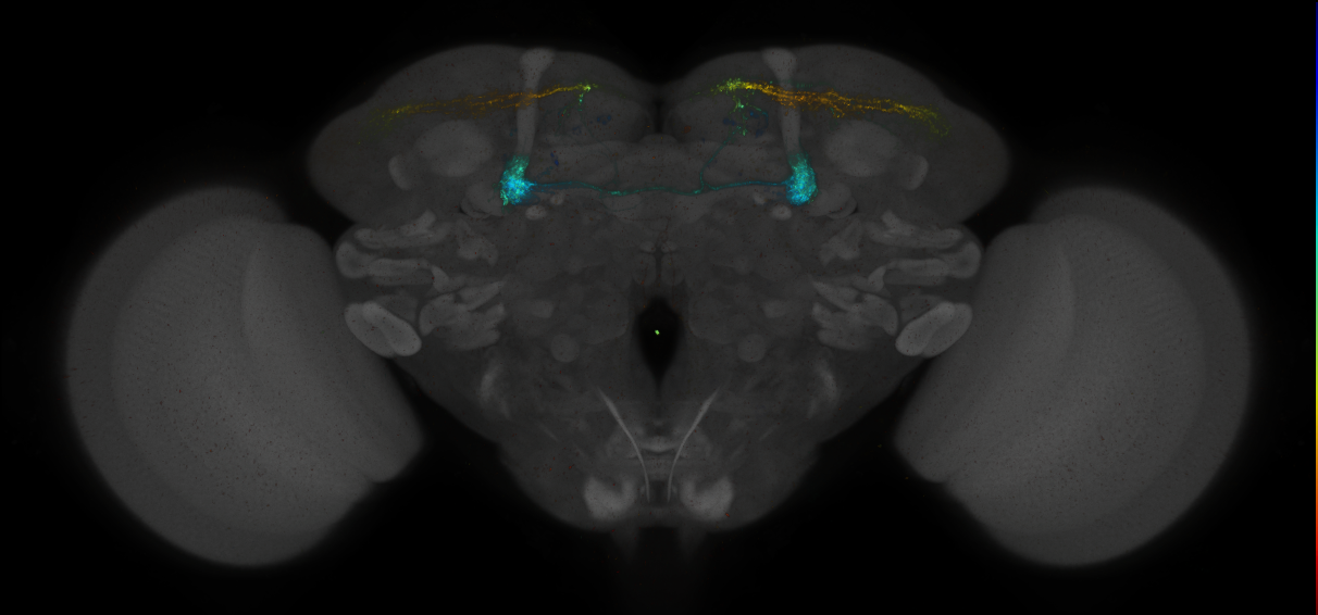 JRC_MB299B_Brain_2014_20140414_31_F2_20x