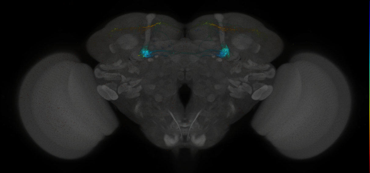 JRC_MB299B_Brain_2014_20140414_31_F3_20x
