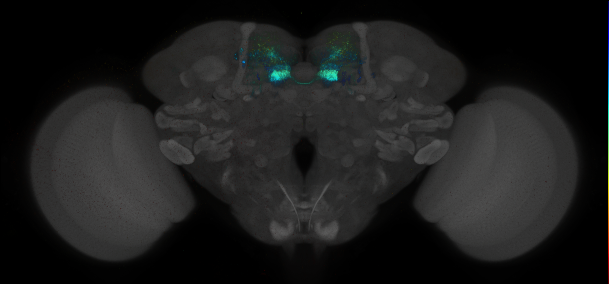 JRC_MB316B_Brain_2014_20140414_31_G1_20x