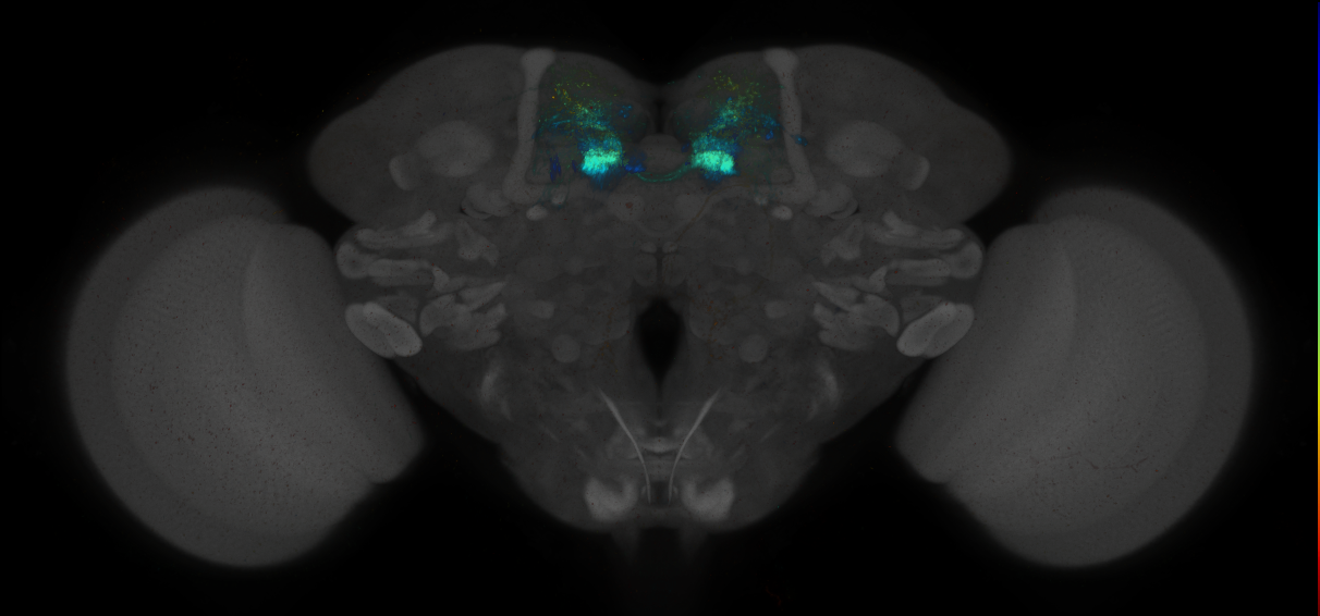 JRC_MB316B_Brain_2014_20140414_31_G2_20x