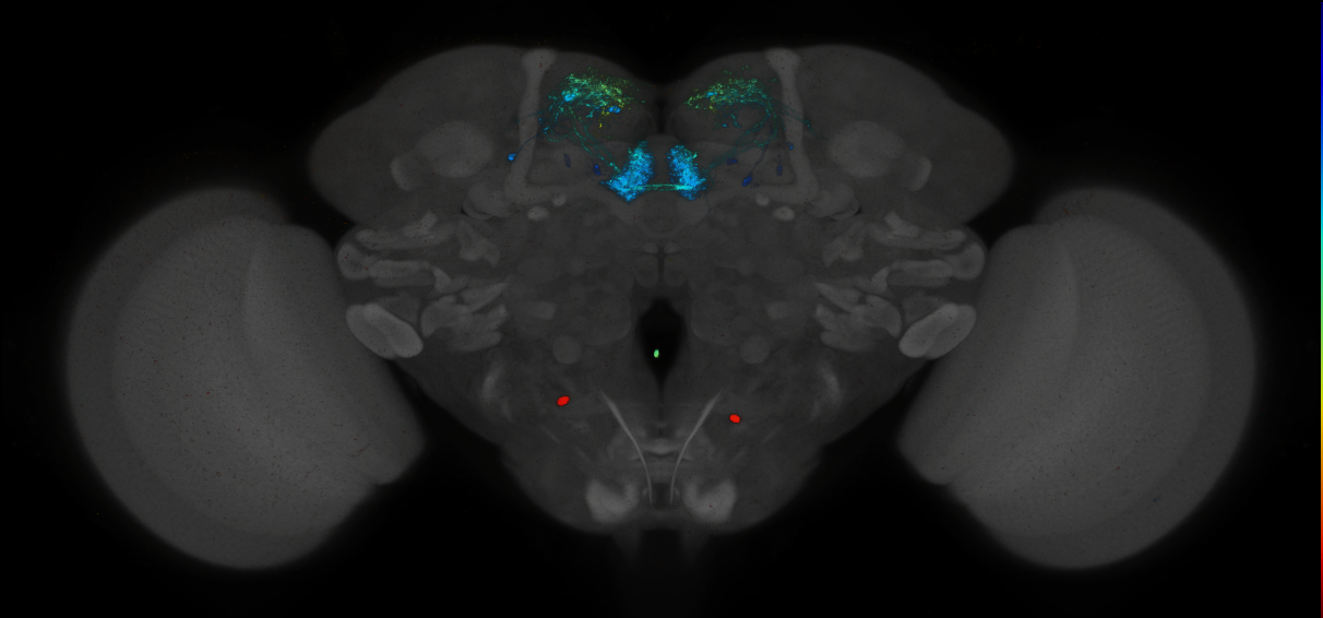 JRC_MB315C_Brain_2014_20140414_32_A1_20x