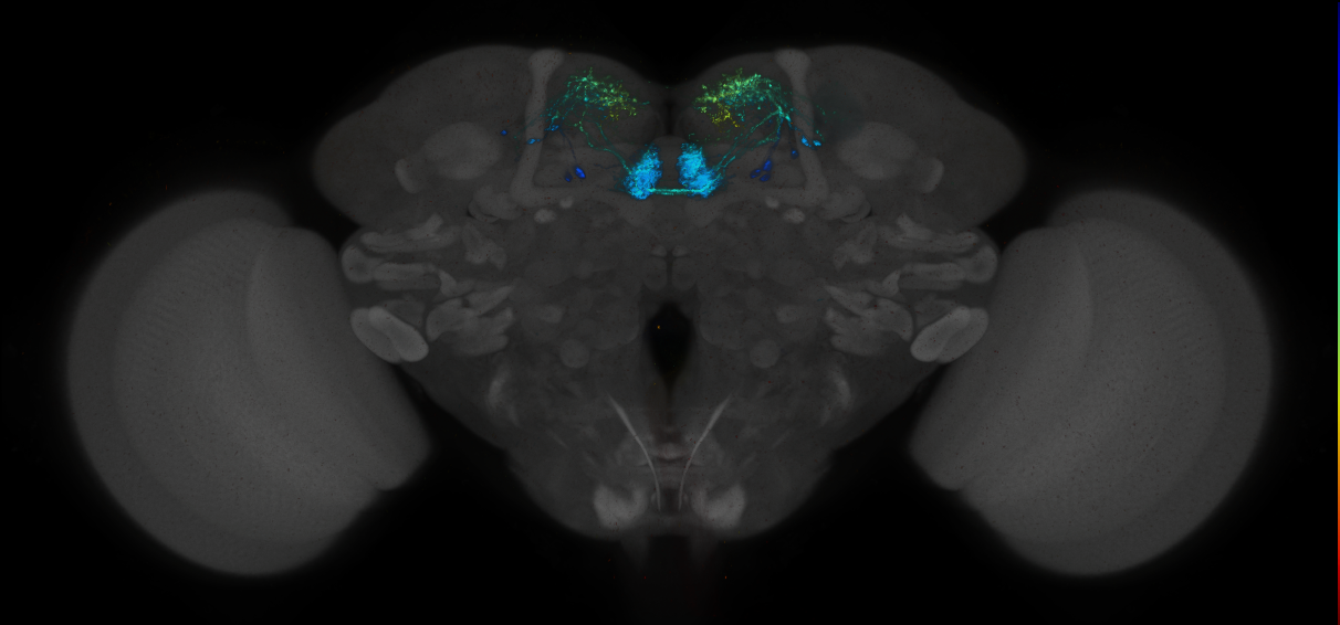 JRC_MB315C_Brain_2014_20140414_32_A2_20x