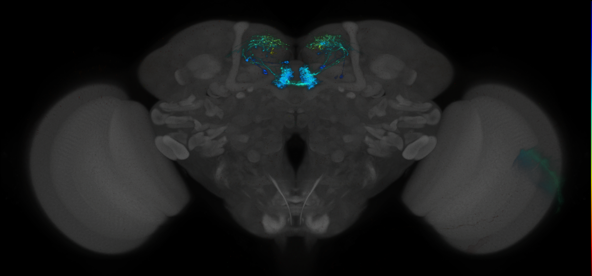 JRC_MB315C_Brain_2014_20140414_32_A3_20x