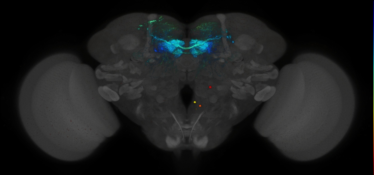 JRC_MB196B_Brain_2014_20140414_32_C1_20x