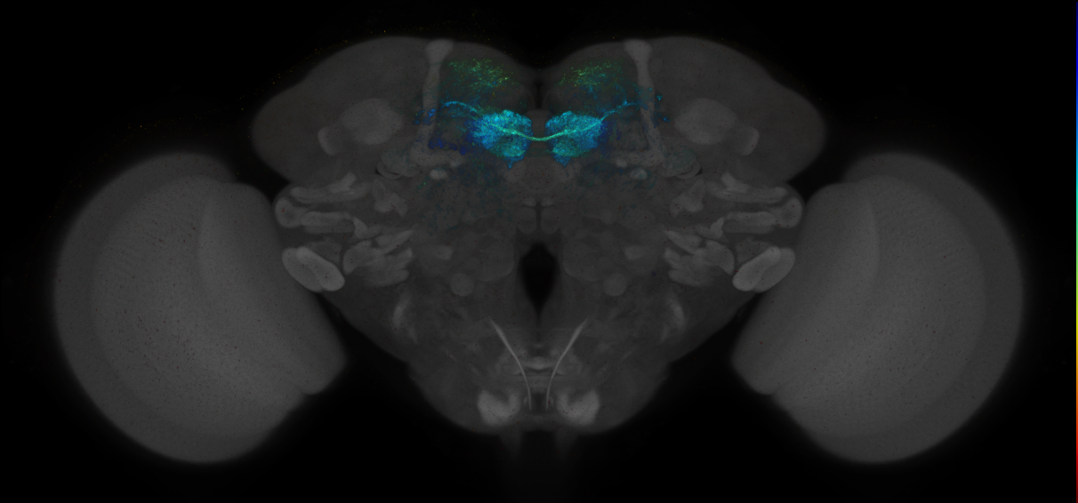 JRC_MB196B_Brain_2014_20140414_32_C2_20x