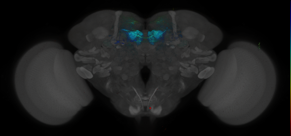 JRC_MB196B_Brain_2014_20140414_32_C3_20x