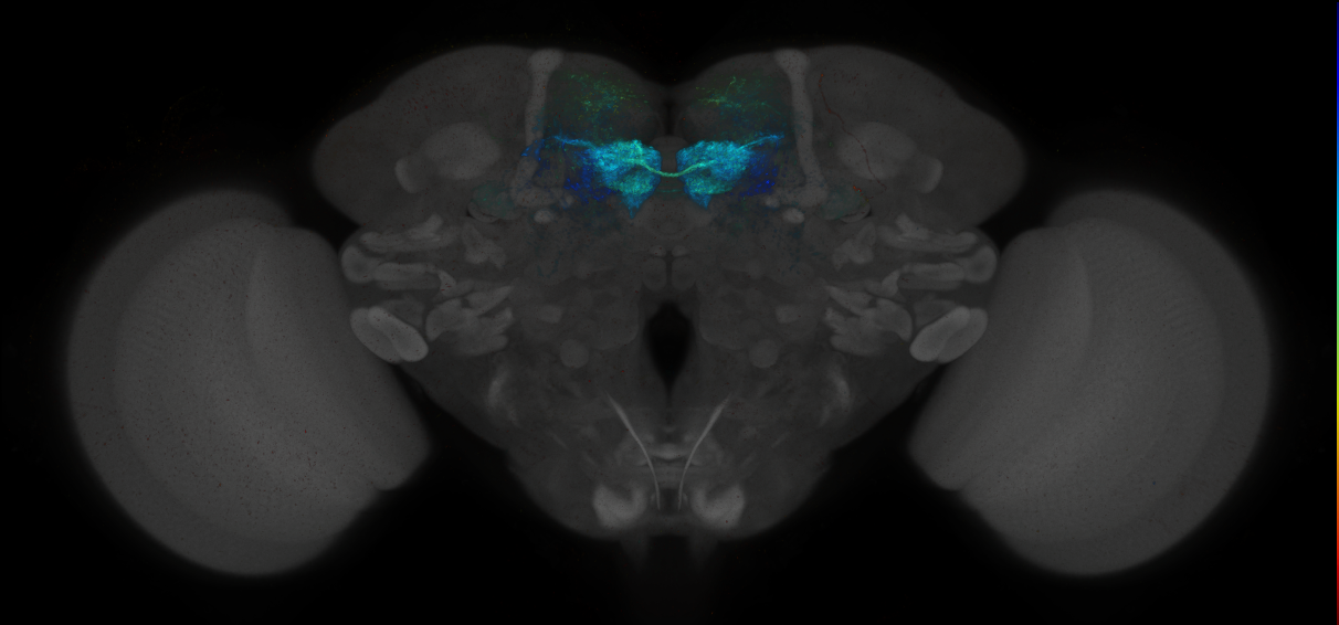 JRC_MB196B_Brain_2014_20140414_32_C4_20x