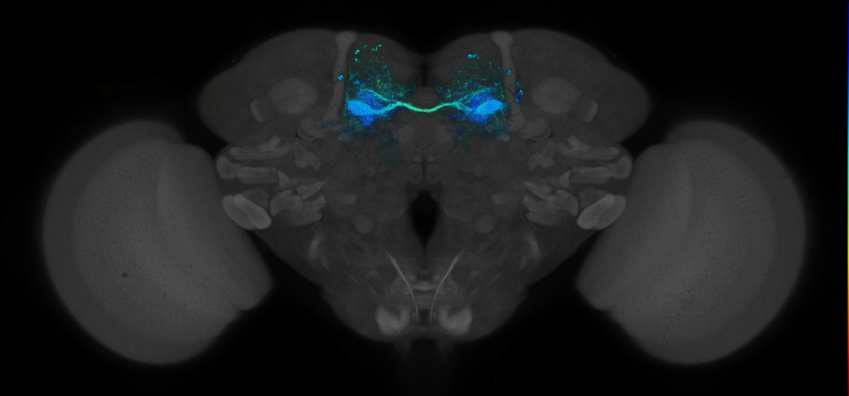 JRC_MB188B_Brain_2014_20140414_32_D1_20x
