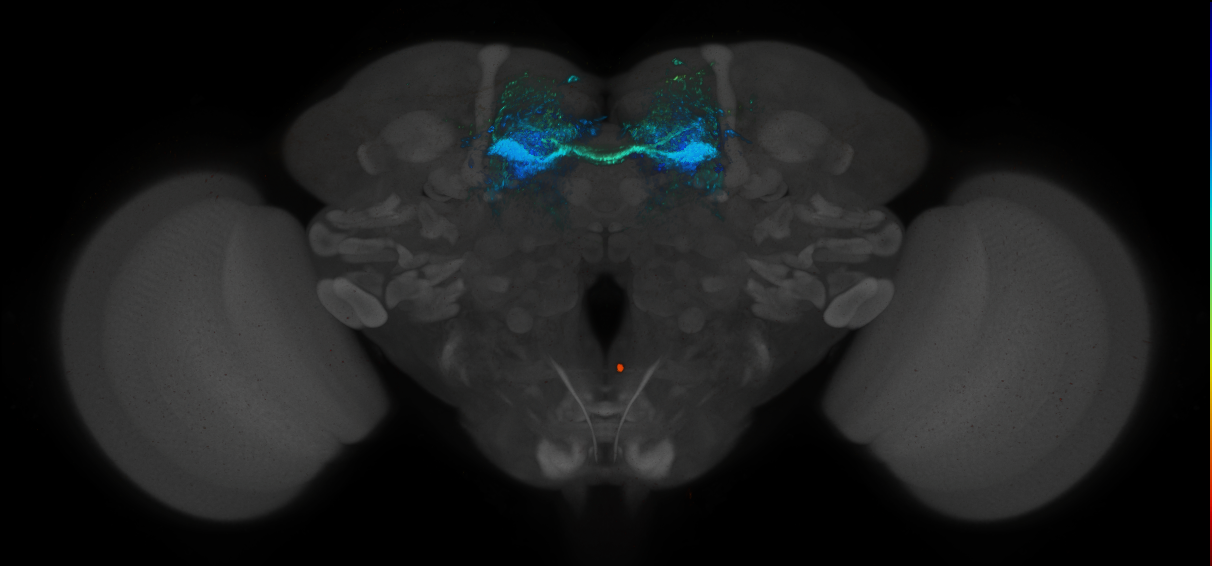 JRC_MB188B_Brain_2014_20140414_32_D2_20x