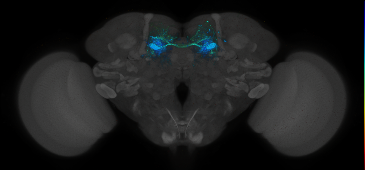 JRC_MB188B_Brain_2014_20140414_32_D3_20x