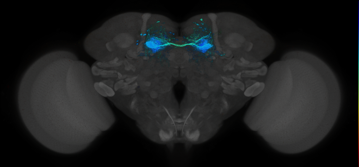 JRC_MB188B_Brain_2014_20140414_32_D4_20x
