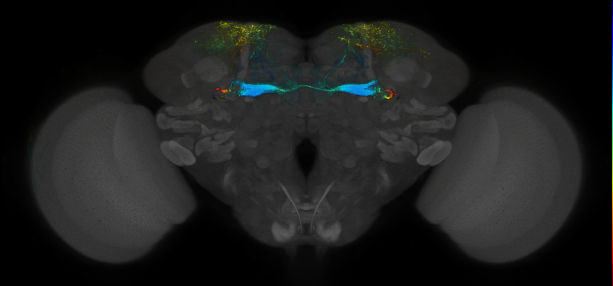 JRC_MB194B_Brain_2014_20140414_32_E3_20x