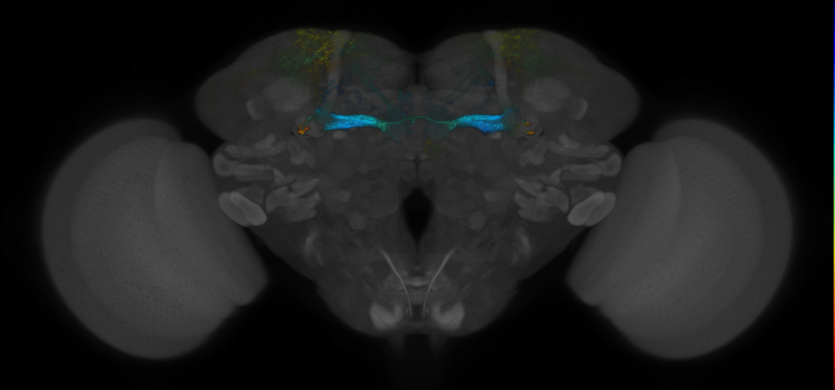 JRC_MB194B_Brain_2014_20140414_32_E4_20x