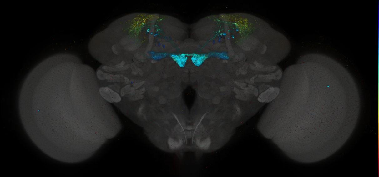 JRC_MB213B_Brain_2014_20140416_31_C2_20x