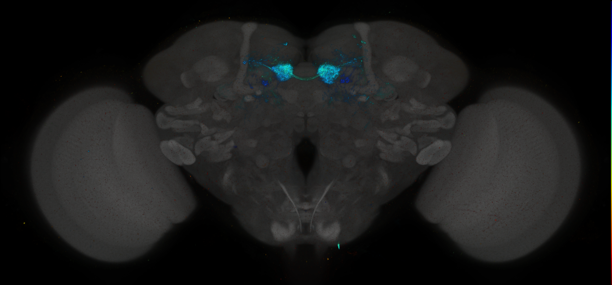 JRC_MB312B_Brain_2014_20140416_31_D2_20x