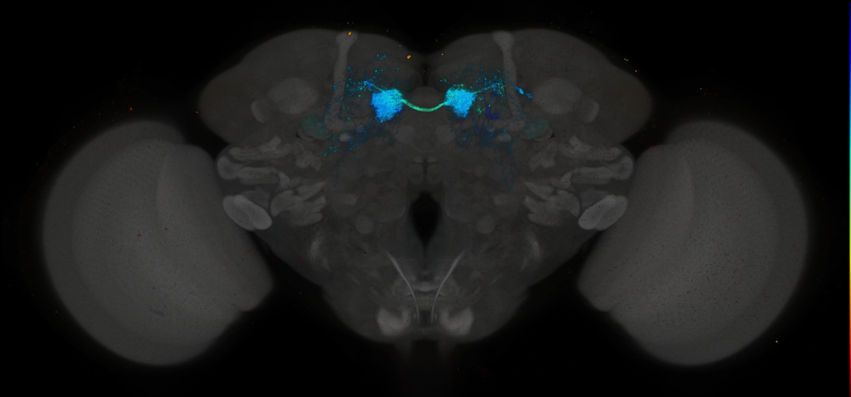 JRC_MB312B_Brain_2014_20140416_31_D4_20x