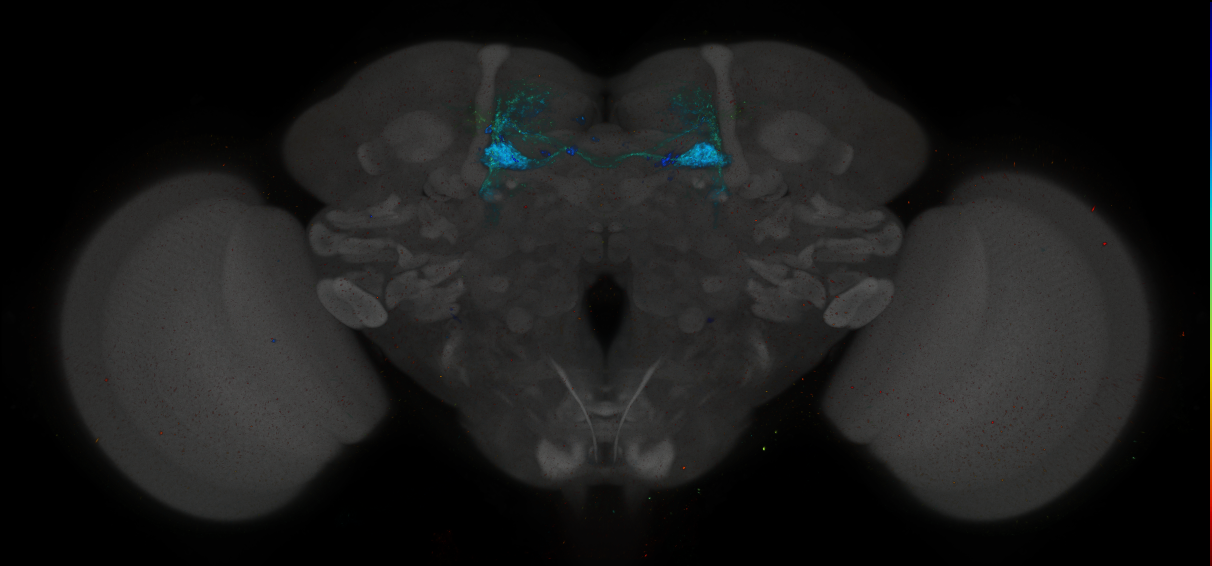 JRC_MB025B_Brain_2014_20140416_31_F1_20x