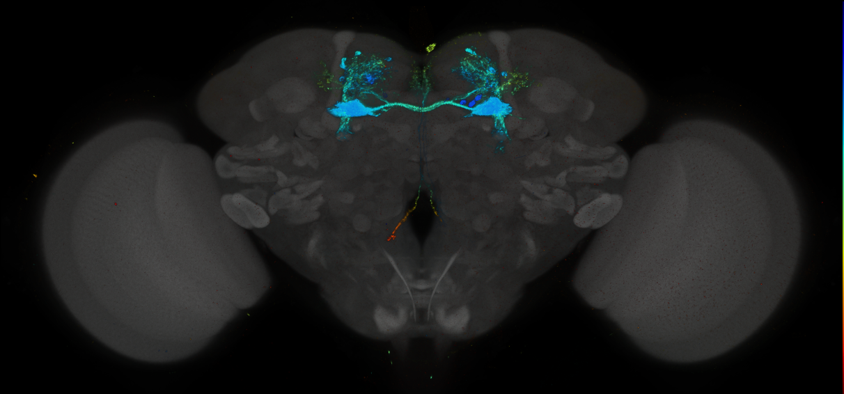 JRC_MB025B_Brain_2014_20140416_31_F2_20x