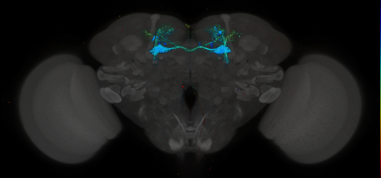 JRC_MB025B_Brain_2014_20140416_31_F3_20x