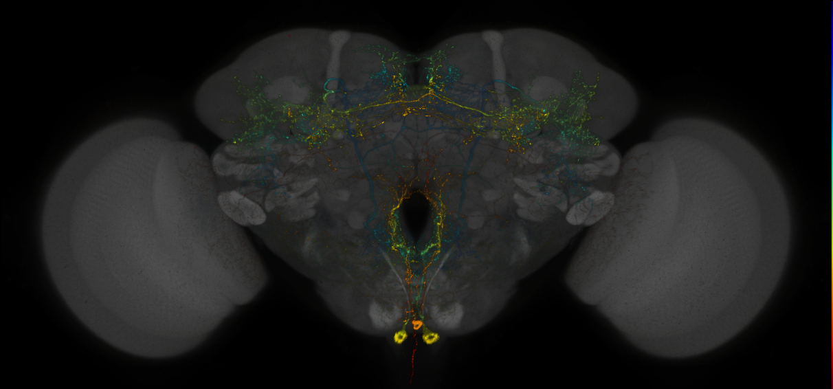 JRC_MB113C_Brain_2014_20140409_32_A2_20x