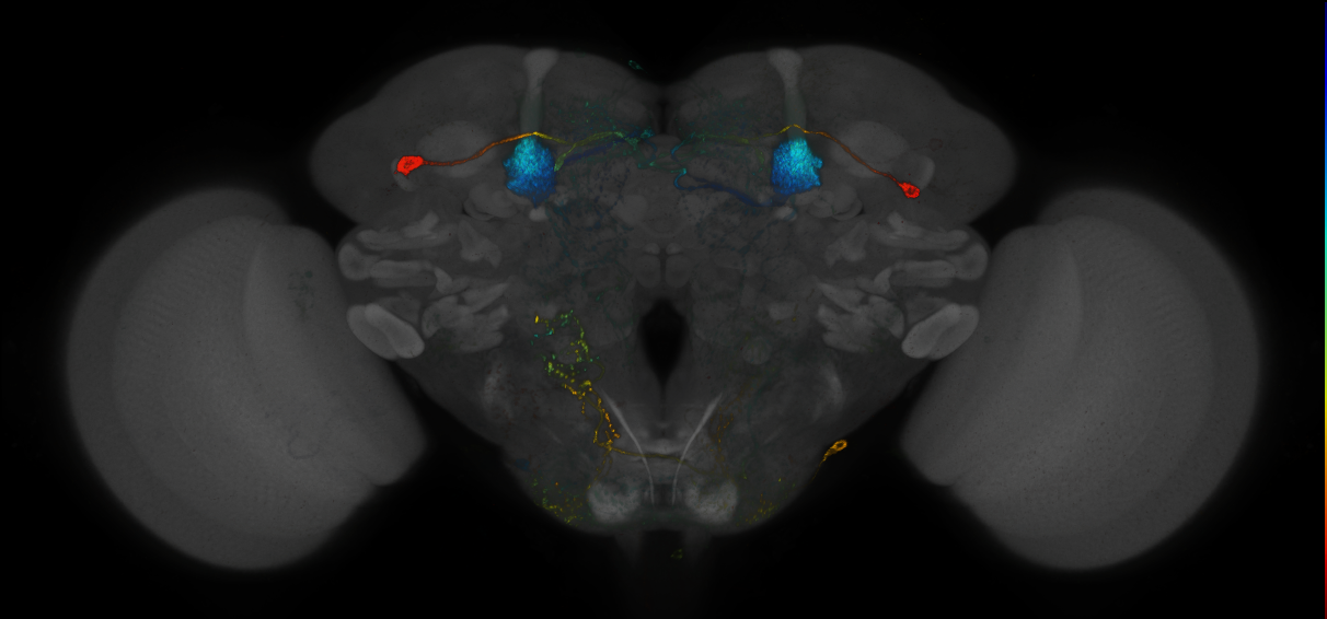 JRC_MB296B_Brain_2014_20140409_32_A6_20x