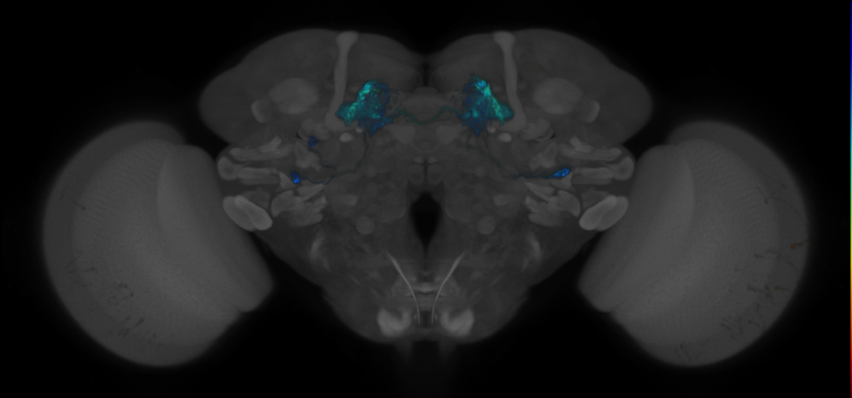 JRC_MB110C_Brain_2014_20140409_32_G1_20x