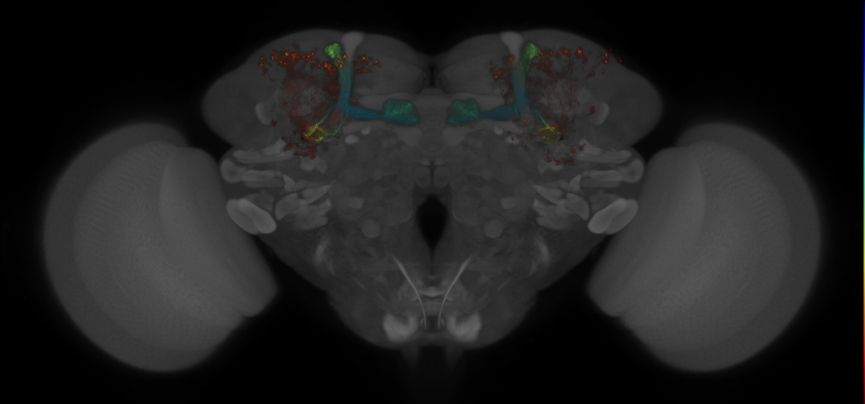 JRC_MB463B_Brain_2014_20140409_32_G3_20x