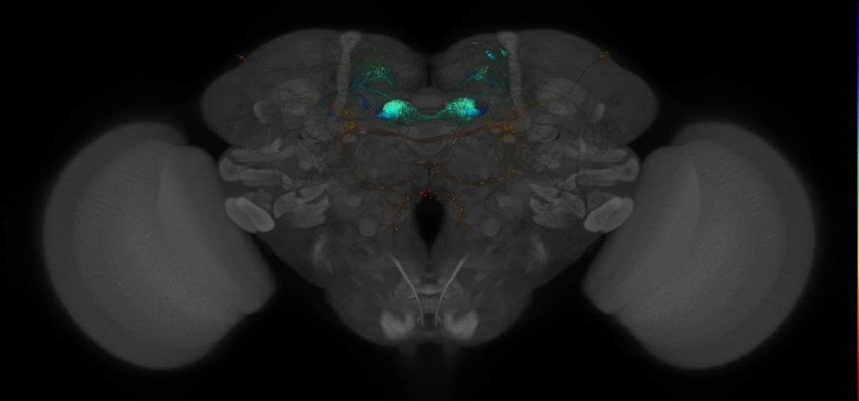 JRC_MB047B_Brain_2014_20140409_32_H4_20x