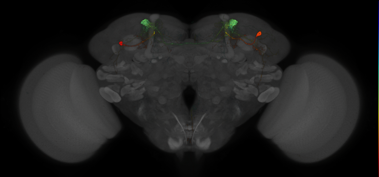 JRC_MB308B_Brain_2014_20140409_32_H6_20x