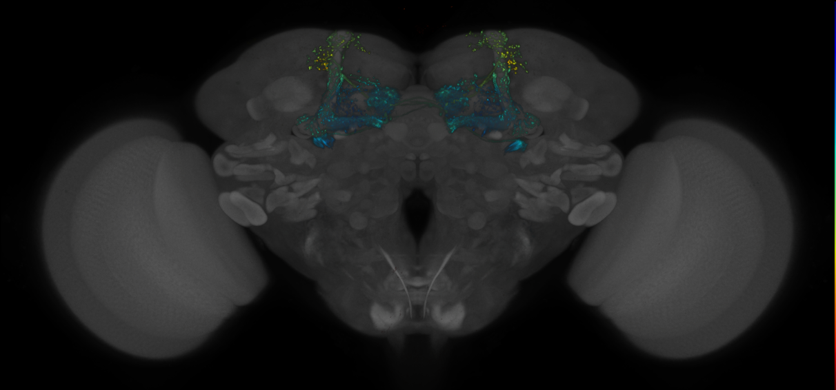 JRC_MB434B_Brain_2014_20140522_31_G2_20x