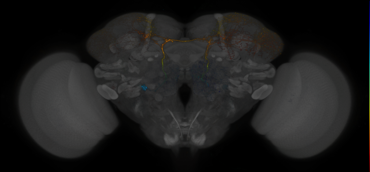 JRC_MB465C_Brain_2014_20140424_41_E3_20x
