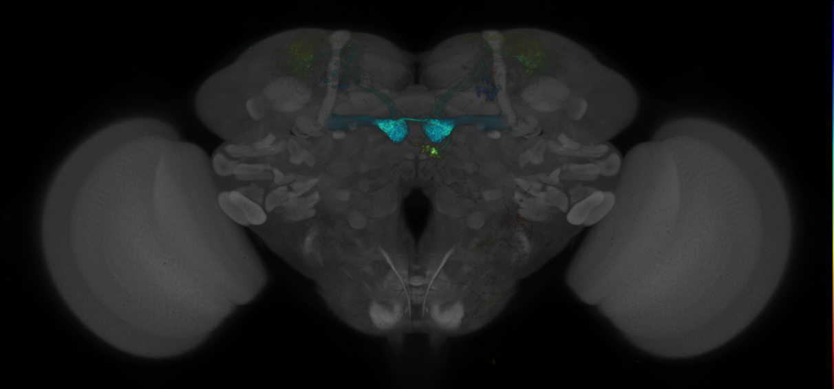 JRC_MB213B_Brain_2014_20140530_41_H1_20x