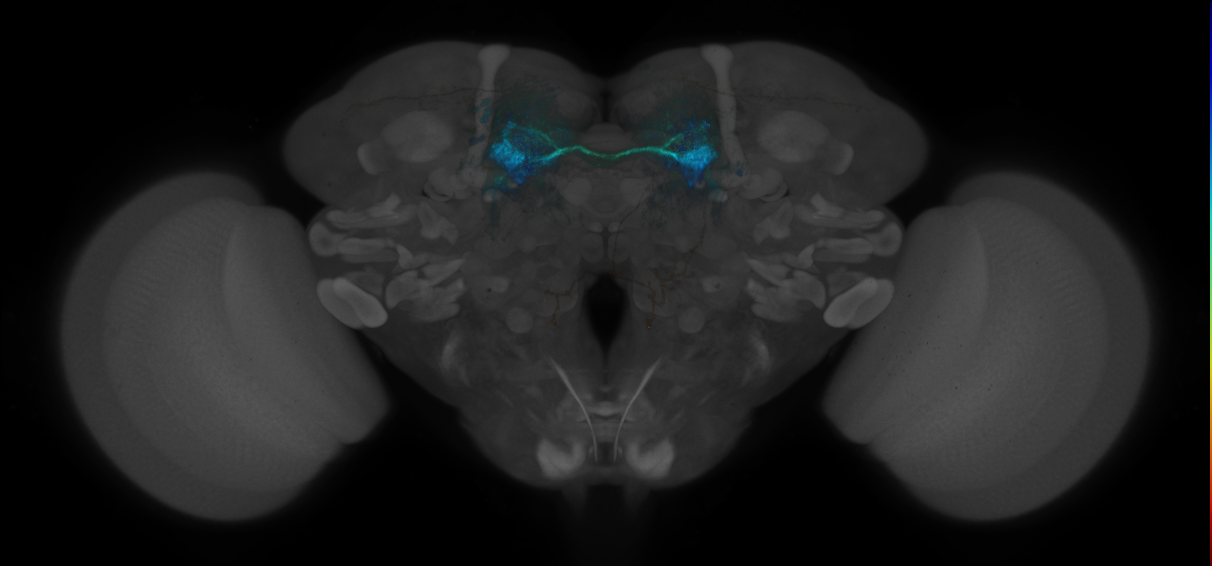 JRC_MB188B_Brain_2014_20140530_41_H3_20x