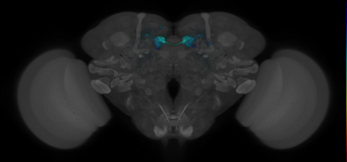 JRC_MB312C_Brain_2014_20140530_41_I3_20x