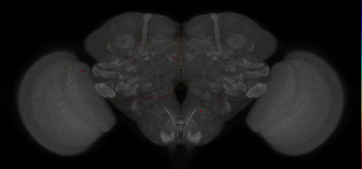 JRC_MB013B_Brain_2014_20121208_31_E1_63x