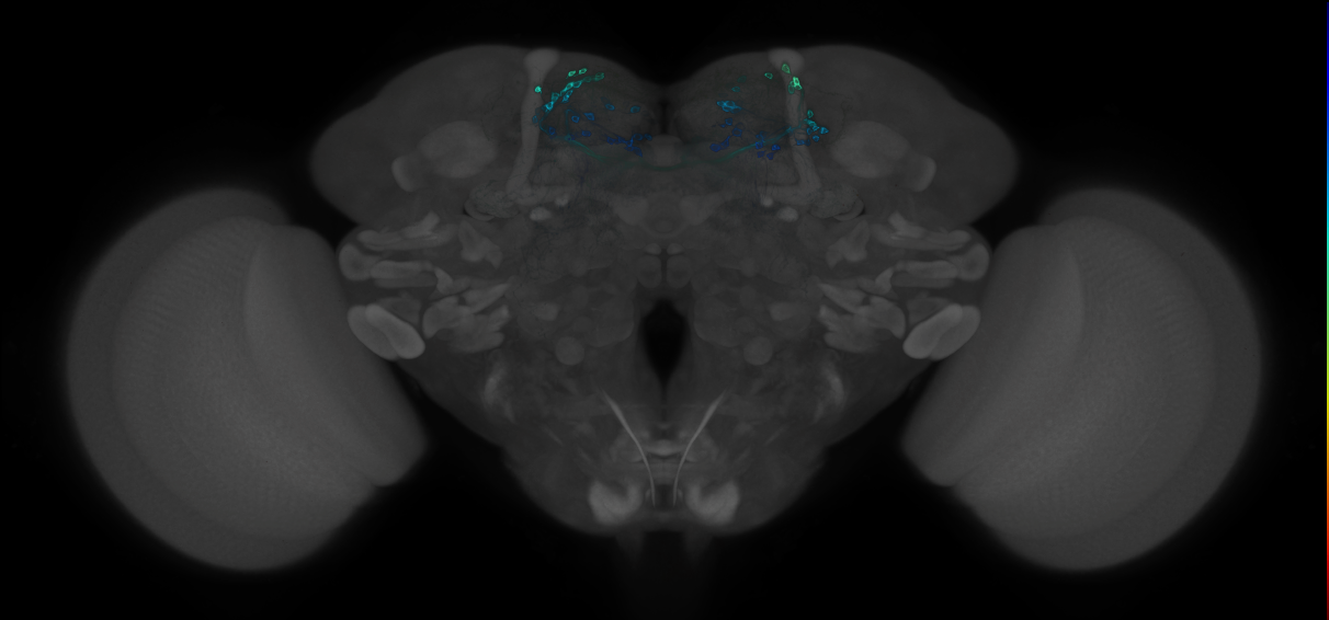 JRC_MB196B_Brain_2014_20121212_31_C2_63x