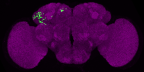 adult DPLal2 lineage neuron