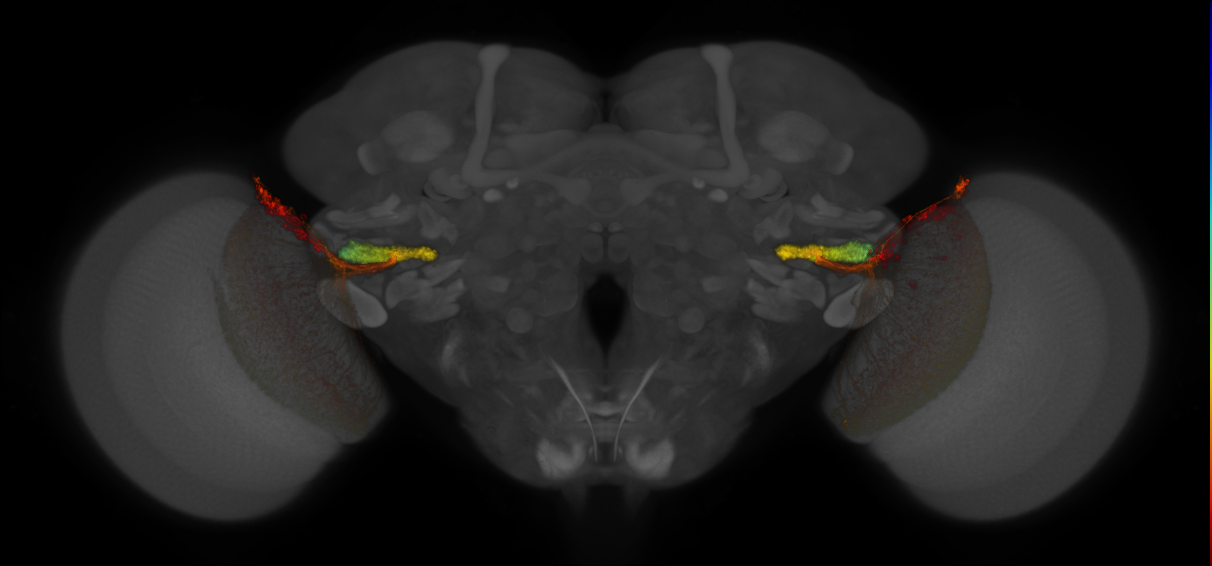 JRC_OL0015B_Brain_2016_20140611_32_D1_20x